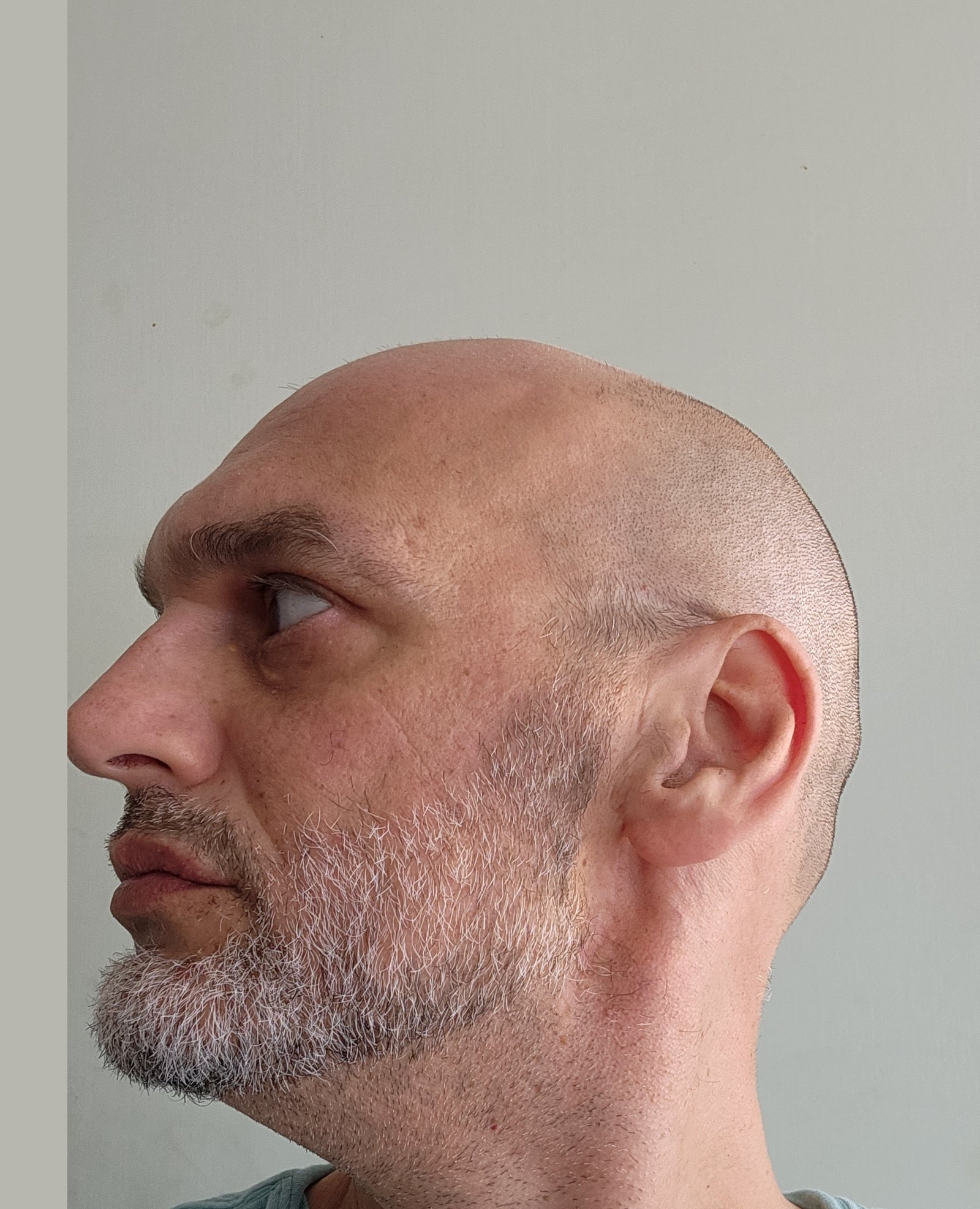 Profile reference photograph